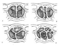 fig02 small