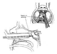 fig12 small