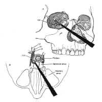 fig15 small