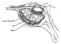 fig16 small